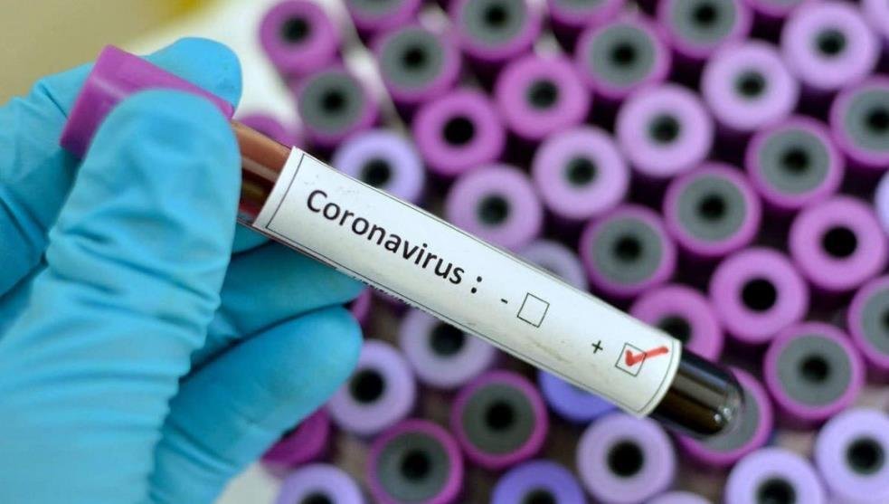 Ahora en Jalisco analizan 3 casos de posible coronavirus