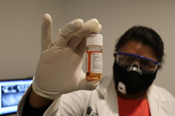 RECABA EDOMÉX CASI 3 MIL TEJIDOS HUMANOS DURANTE EL PRESENTE AÑO