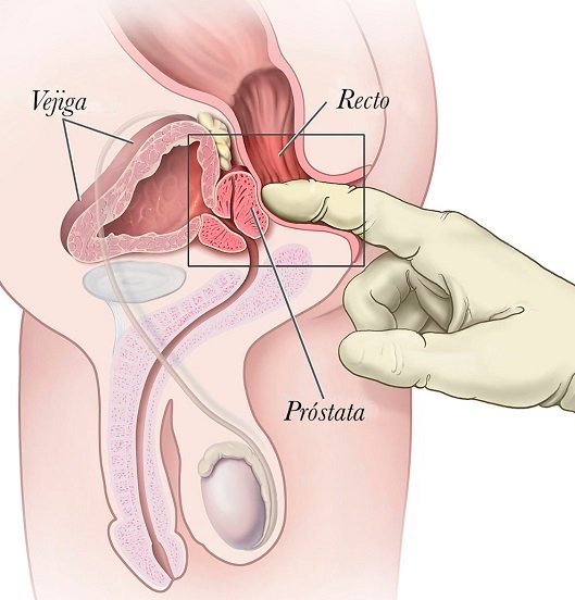 CÁNCER DE PRÓSTATA PROVOCA MUERTE DE 7 MIL HOMBRES EN MÉXICO; ES TIEMPO DE PREVENCIÓN: ISSSTE