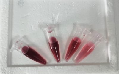 Desarrolla IPN un biosensor coloidal para diagnosticar daño renal agudo en etapas iniciales