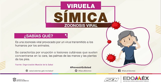 No hay casos de “viruela símica” en el Estado de México, informan autoridades epidemiológicas