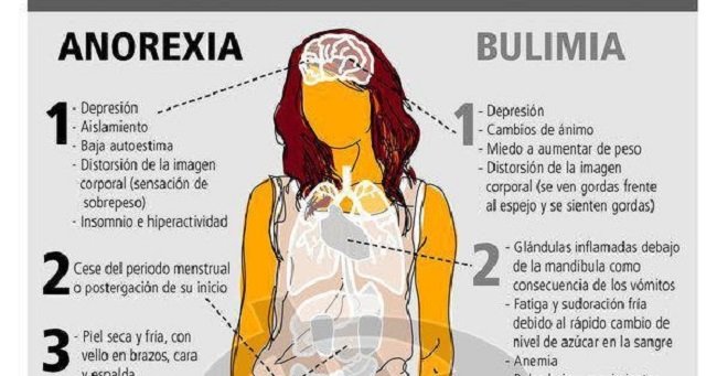 Proponen establecer políticas públicas que prevengan y erradiquen la anorexia y bulimia