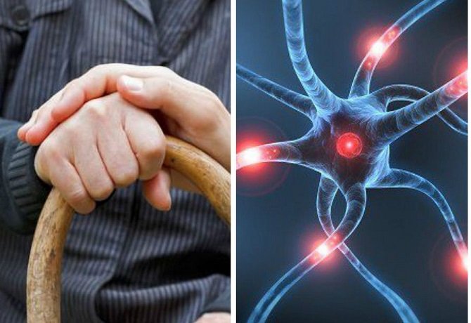 PARKINSON ENFERMEDAD NEUROLÓGICA QUE VA EN AUMENTO