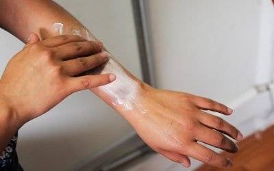 A TOMAR PRECAUCIONES PARA PREVENIR DAÑOS EN LA PIEL DURANTE TEMPORADA DE CALOR