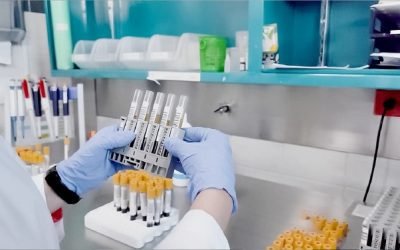 PRUEBAS DE ANTÍGENO PROSTÁTICO SON HERRAMIENTA INICIAL PARA LA DETECCIÓN DE CÁNCER DE PRÓSTATA
