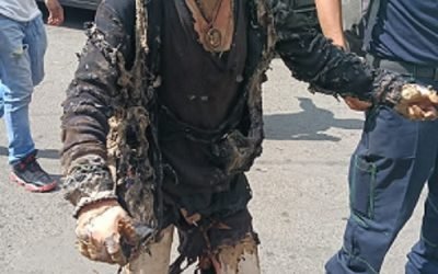 Suman 57 heridos por explosión de pipa en Puente de la Concordia; 19 graves